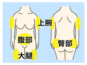 皮下注射部位イメージ