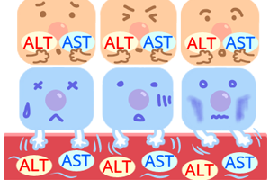 第6回　肝細胞傷害の指標　ASTとALT