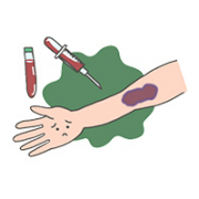 第3回 血液に作用する抗血小板薬・抗凝固薬
